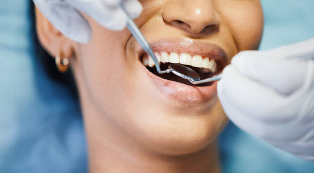 Best Emergency Denture Repair in Waynesville, MO